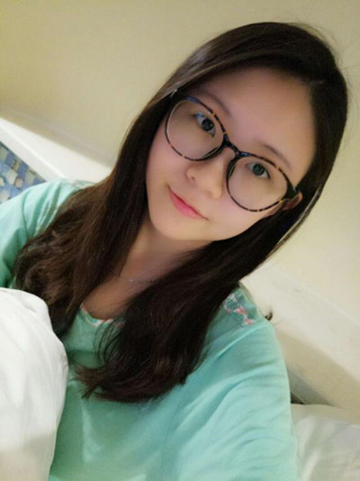 海南添美整形外科医生王晓军做自体软骨隆鼻+双眼皮+祛眼袋案例效果对比图