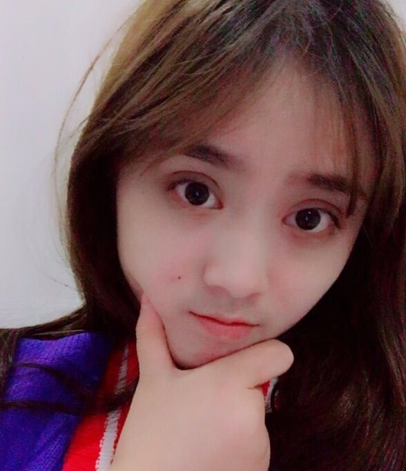 福州爱美尔整形黄林胜双眼皮案例效果对比图