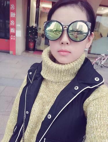杨勇山双眼皮案例展示