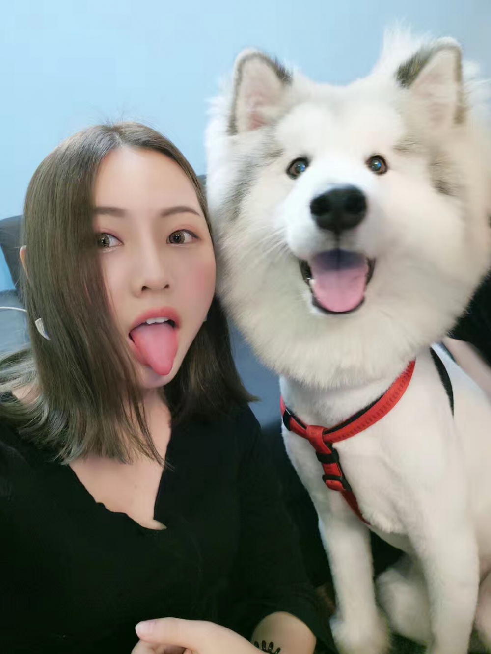 整形医生徐长亮做切开双眼皮案例效果对比图