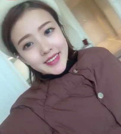 成都汉密尔顿牙齿矫正案例