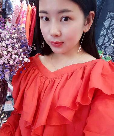 杨勇山双眼皮案例展示