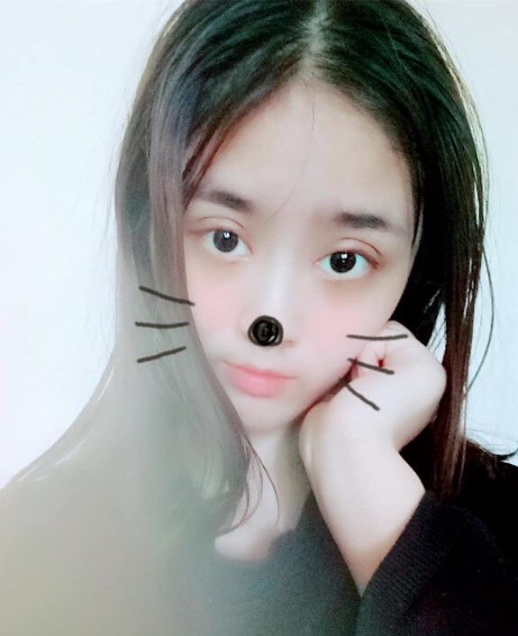 福州爱美尔整形黄林胜双眼皮案例效果对比图