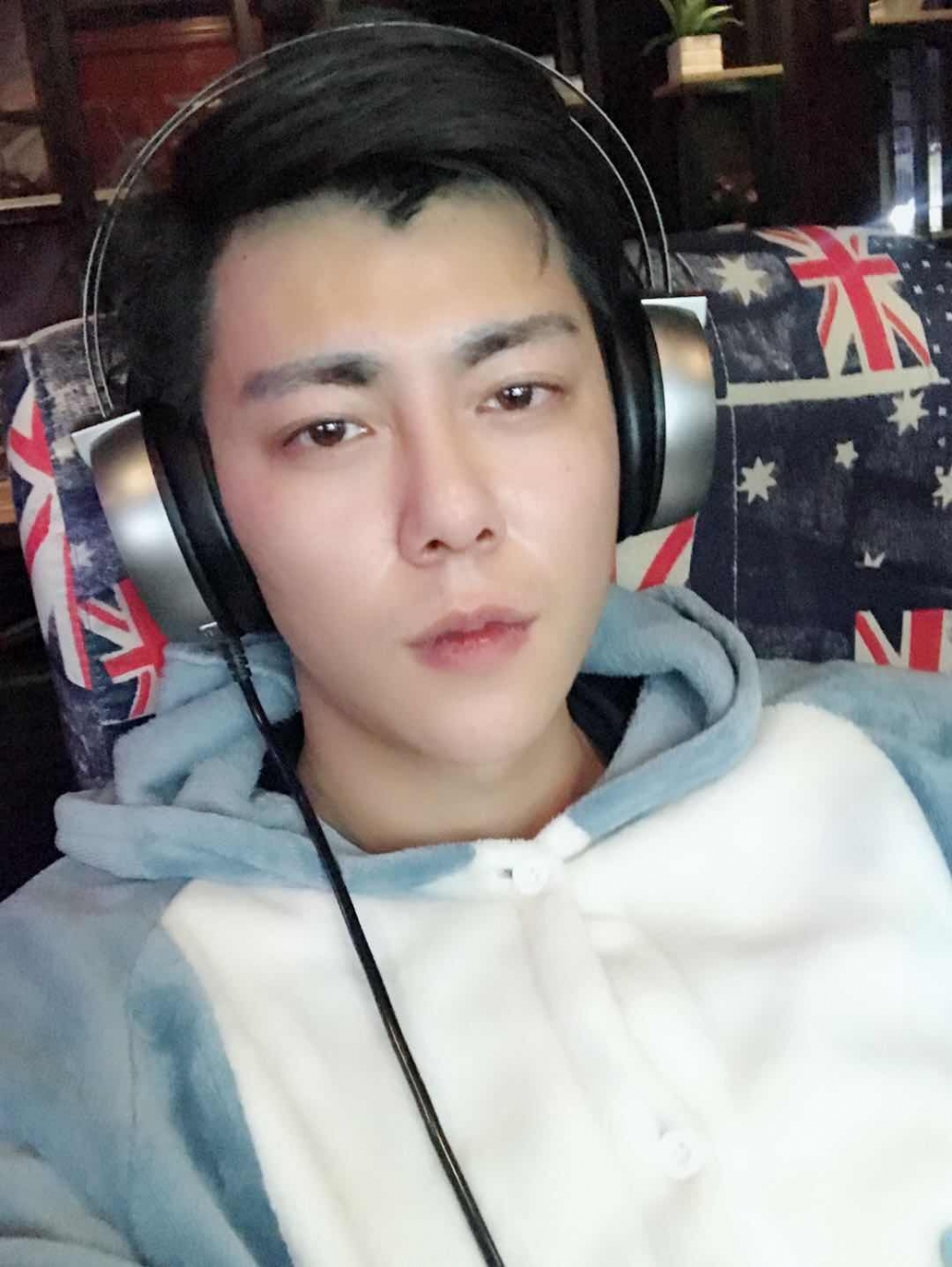 济宁名美医疗整形医生李唯少假体隆鼻+耳软骨垫鼻尖真实案例效果对比图