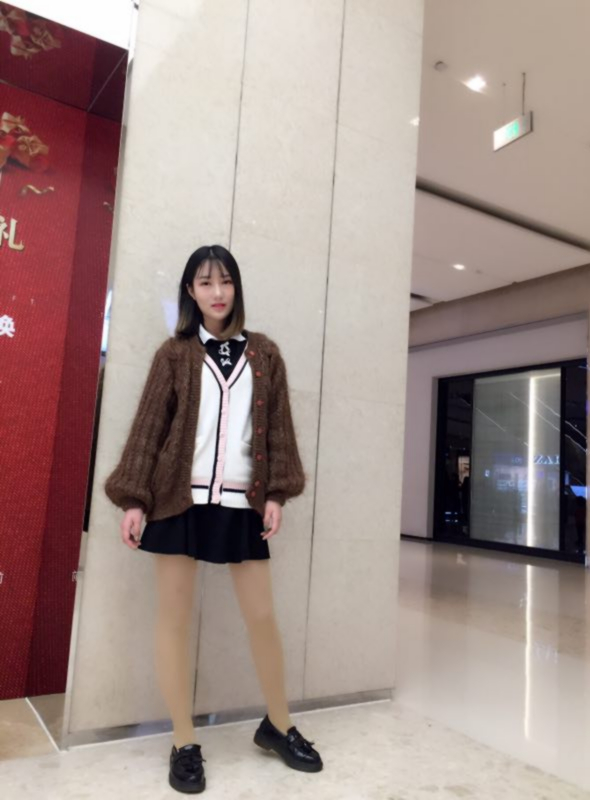 成都美立方整形医院黄华医生做大腿吸脂怎么样？附大腿吸脂案例