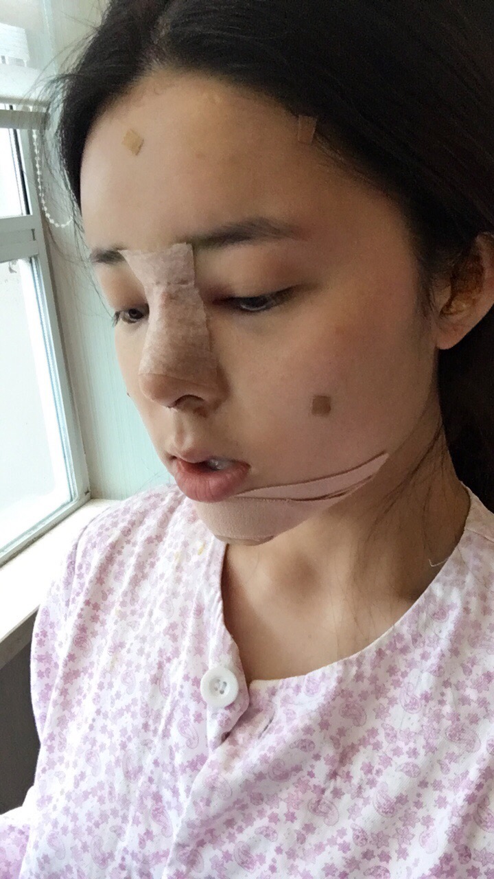 北京世济周志强医生鼻综合案例