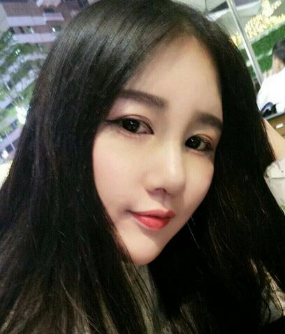 汉中韩美整形医生常双模假体隆鼻+耳软骨垫鼻尖真实案例效果图