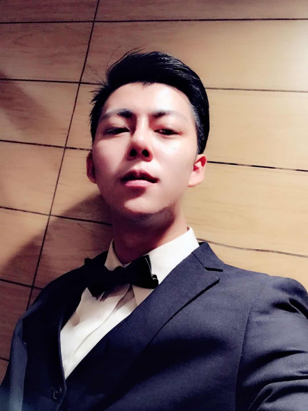 济宁名美医疗整形医生李唯少假体隆鼻+耳软骨垫鼻尖真实案例效果对比图