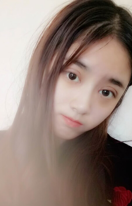 福州爱美尔整形黄林胜双眼皮案例效果对比图