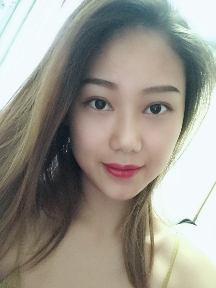 西安艺星整形医院徐智慧医生做埋线提升怎么样？附西安艺星埋线提升案例