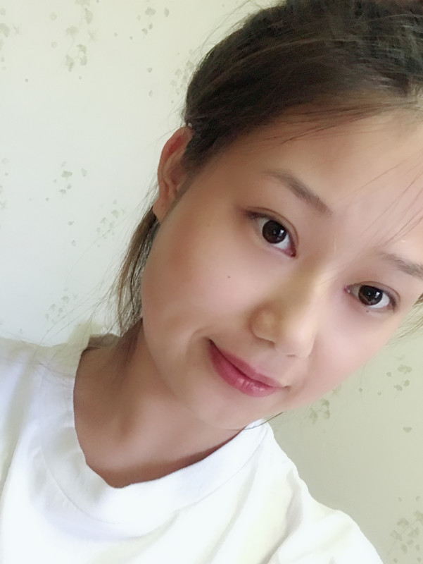 西安艺星埋线提升案例