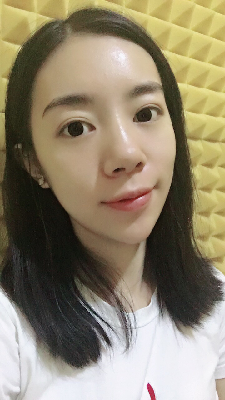 做完祛眼袋手术7天