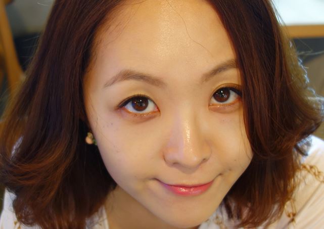 徐州时光洪扬医疗美容诊所宫昔愿医生做激光祛斑效果怎么样？