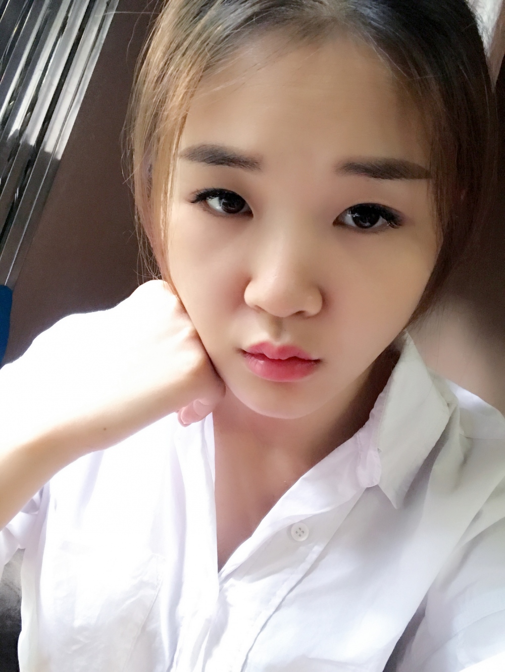 郑州华领医疗美容医院贺小虎医生做眼综合+鼻部整形手术效果怎么样？