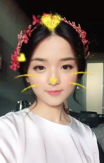 郑州名门整形医院董斌医生做下颌角整形怎么样？附下颌角整形案例