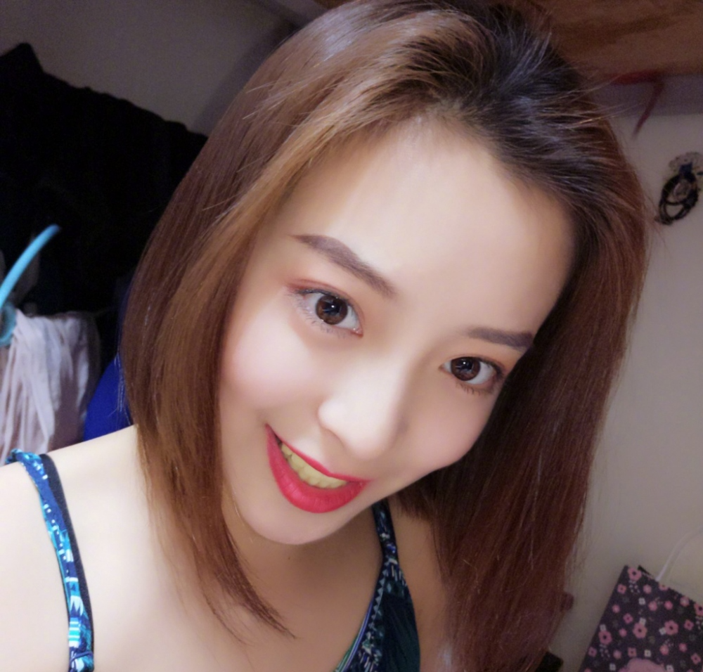 重庆乐乐欣口腔赵丽丽医生做冷光美白效果怎么样？附冷光美白效果对比图