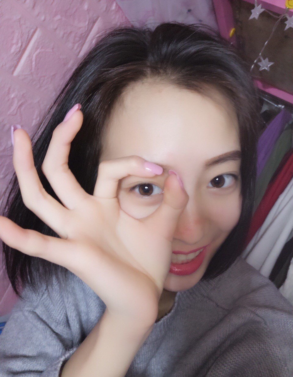 重庆乐乐欣口腔赵丽丽医生做冷光美白效果怎么样？附冷光美白效果对比图