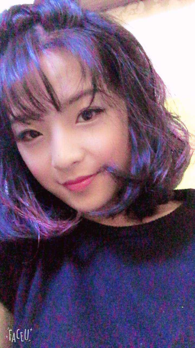 郑州名门整形医院董斌医生做下颌角整形怎么样？附下颌角整形案例