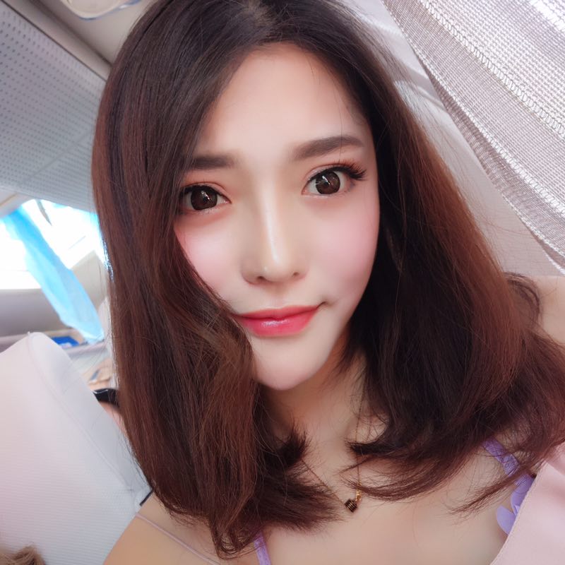 郑州童一颜整形医生李永胜做假体隆鼻+耳软骨隆鼻案例效果对比图