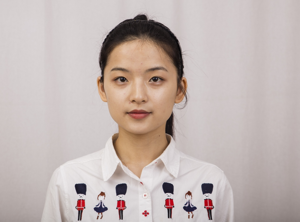 郑州名门整形医院董斌医生做下颌角整形怎么样？附下颌角整形案例