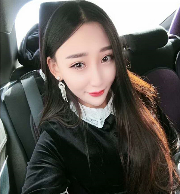 武汉中翰整形外科医院沈磊医生做切开双眼皮怎么样？附沈磊切开双眼皮案例
