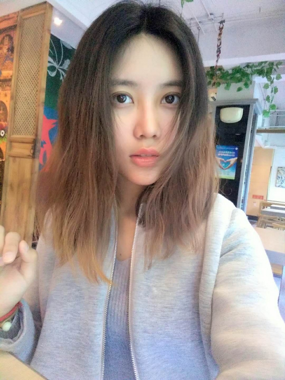 重庆美圣美邦整形医院刘力维医生做自体脂肪全脸填充案例效果对比图
