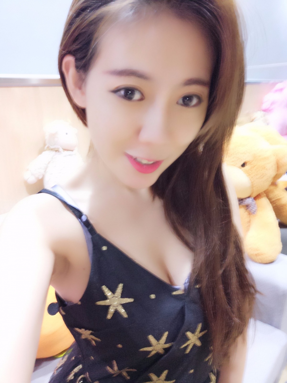 烟台壹美整形医院朱建莹医生做自体脂肪隆胸怎么样？附自体脂肪隆胸案例