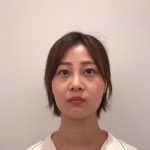 天津欧华威莎整形医生姚玲做面部埋线提升效果怎么样？附埋线提升案例