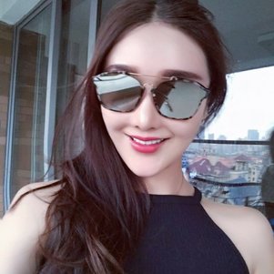 广州柏德口腔兰海龙医生做瓷贴面效果怎么样？广州柏德口腔瓷贴面案例分享