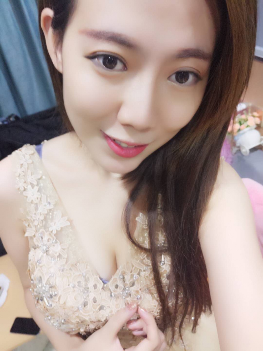 烟台壹美整形医院朱建莹医生做自体脂肪隆胸怎么样？附自体脂肪隆胸案例