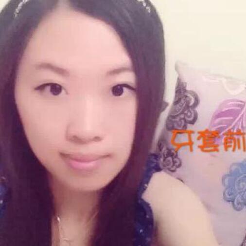 重庆嘉悦口腔医院周继祥医生做金属托槽矫正效果怎么样？附案例效果对比图