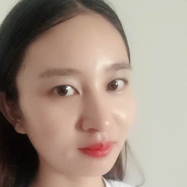 武汉维纳斯整形医院赵瑾医生做玻尿酸垫下巴怎么样？附玻尿酸垫下巴案例