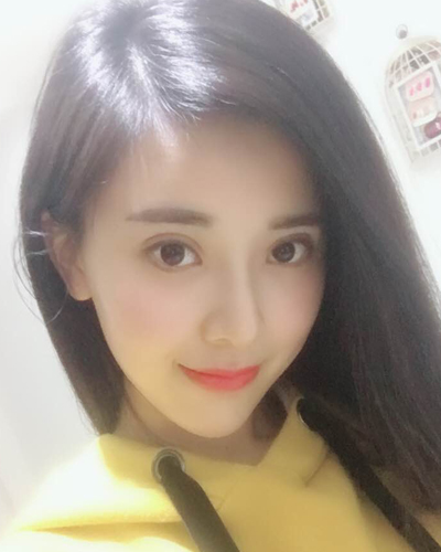 襄阳维多利亚整形医院安邰晥医生做鼻综合整形怎么样？附鼻综合整形案例