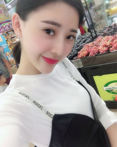 襄阳维多利亚整形医院安邰晥医生做鼻综合整形怎么样？附鼻综合整形案例