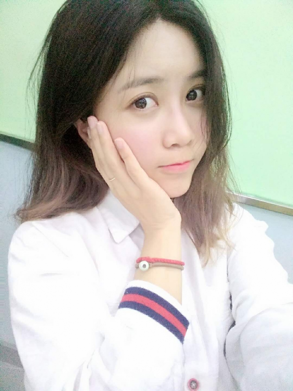 重庆美圣美邦整形医院刘力维医生做自体脂肪全脸填充案例效果对比图