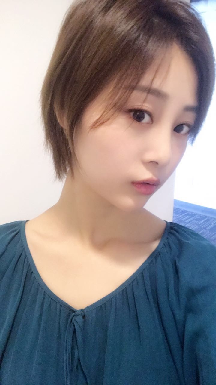天津欧华威莎整形医生姚玲做面部埋线提升效果怎么样？附埋线提升案例
