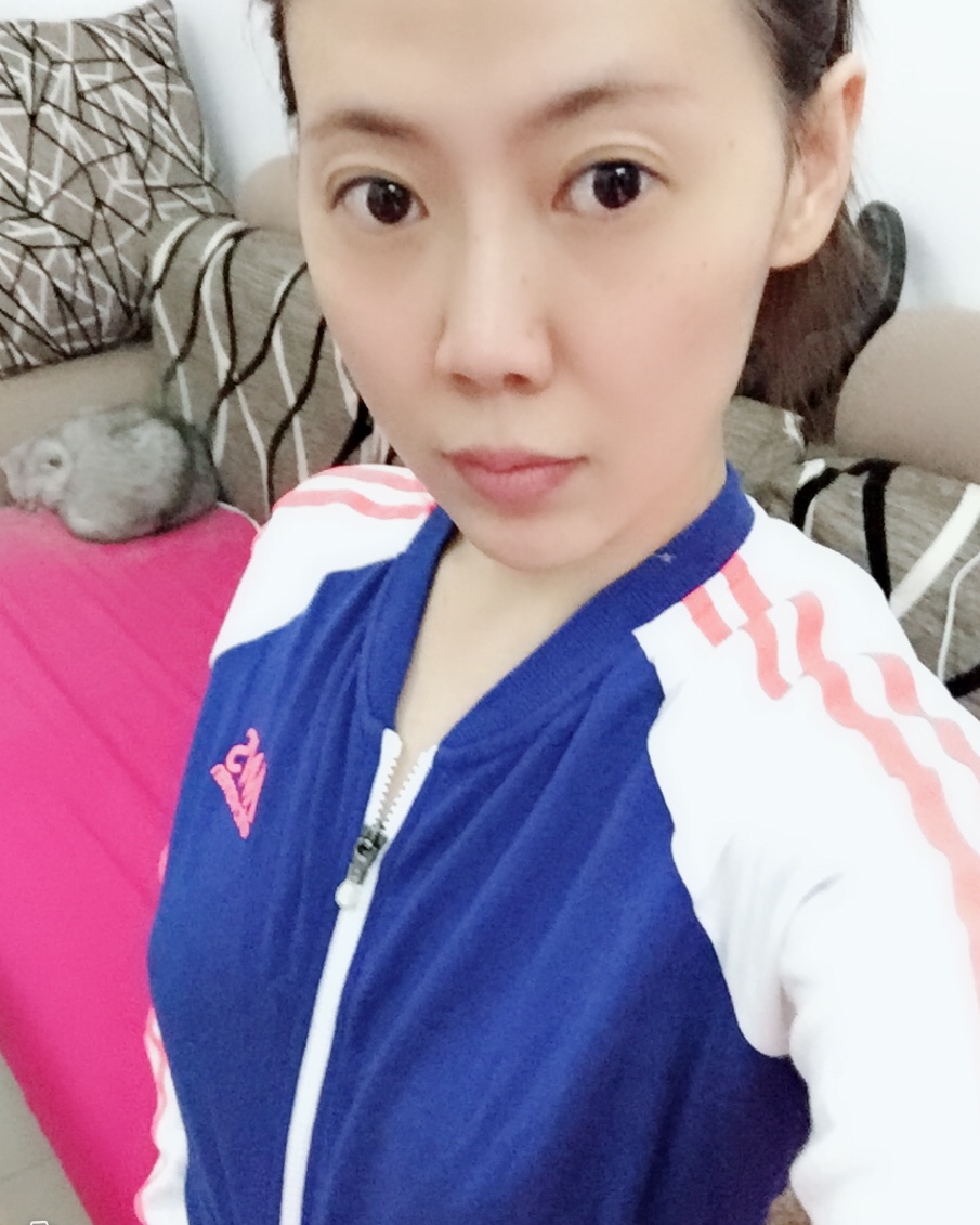 烟台壹美整形医院朱建莹医生做自体脂肪隆胸怎么样？附自体脂肪隆胸案例