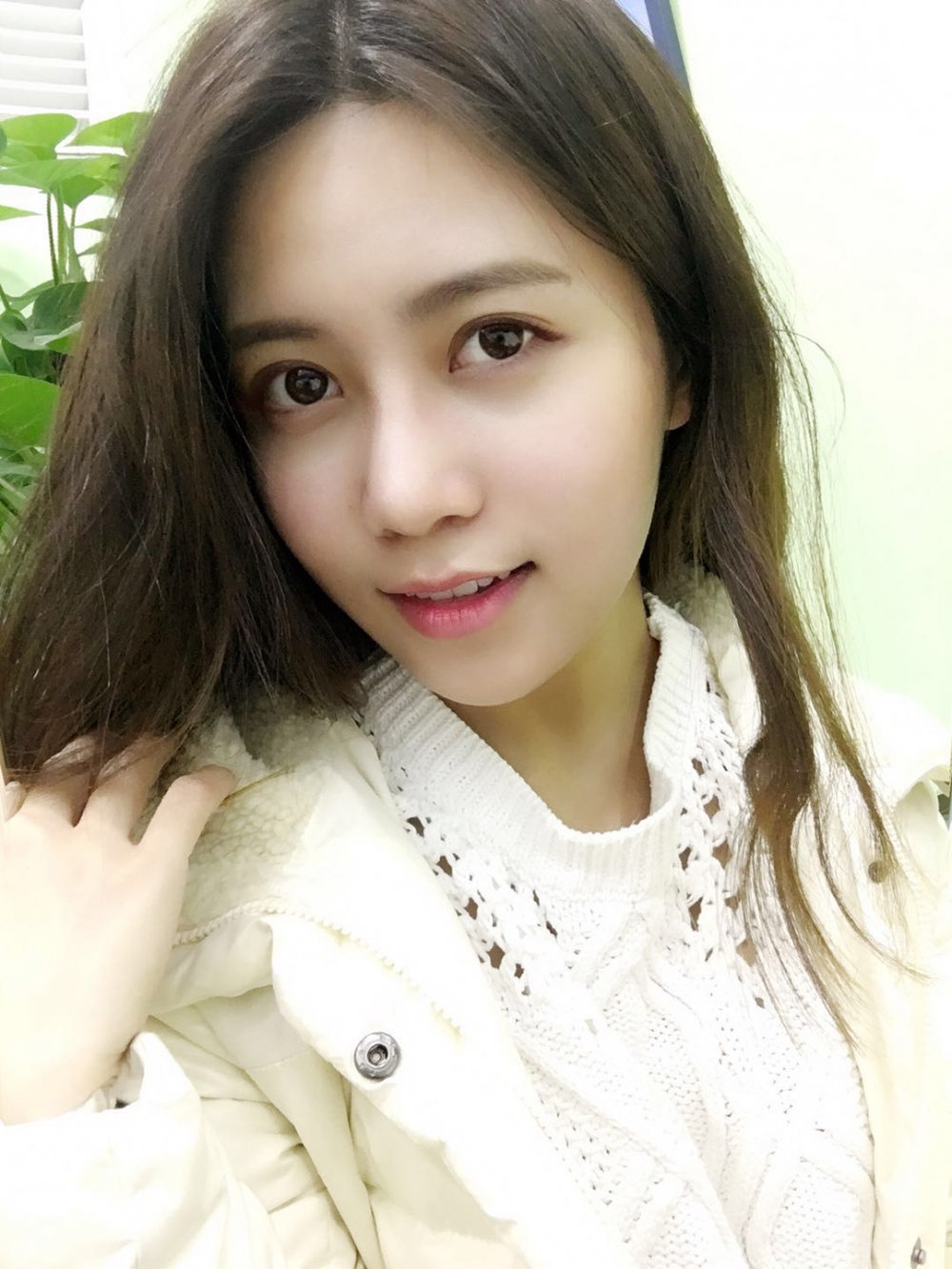 重庆美圣美邦整形医院刘力维医生做自体脂肪全脸填充案例效果对比图