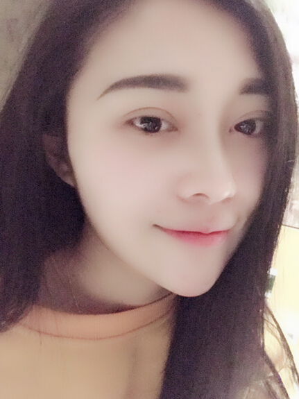 石家庄雅芳亚整形医生王文明做双眼皮+开眼角+鼻综合整形案例效果对比图
