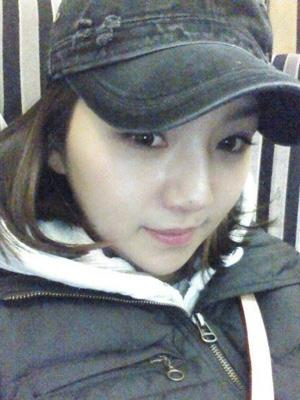 长春中妍整形医院吴学军医生做玻尿酸垫下巴+玻尿酸丰太阳穴案例效果对比图