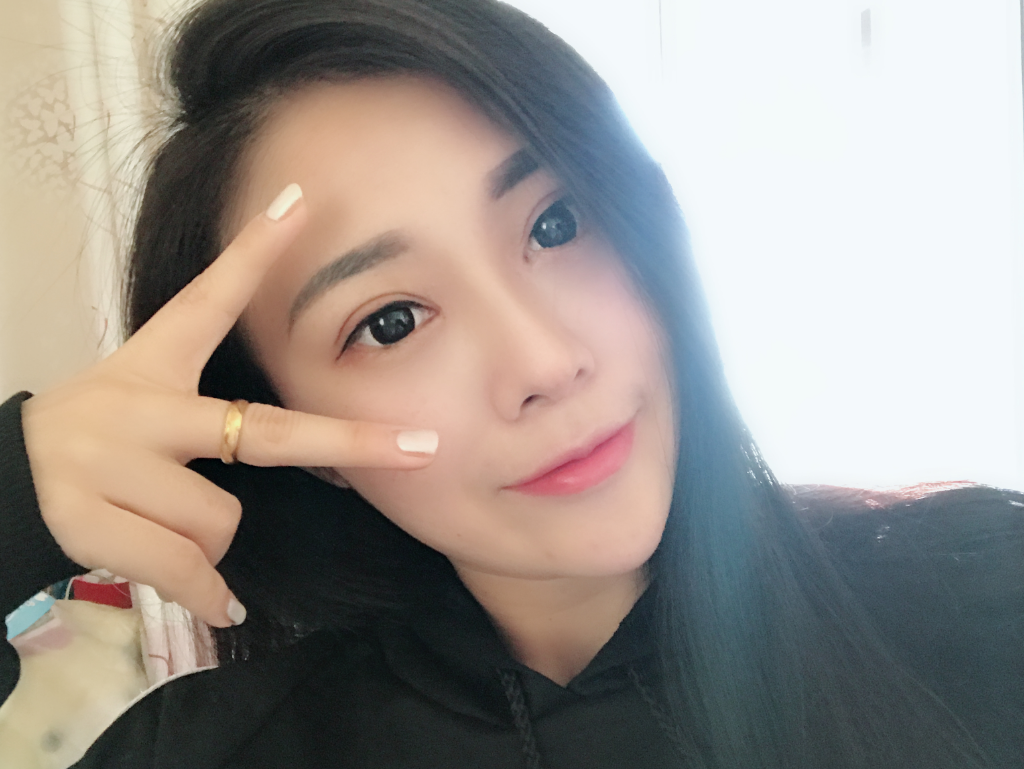 石家庄雅芳亚整形医生王文明做双眼皮+开眼角+鼻综合整形案例效果对比图