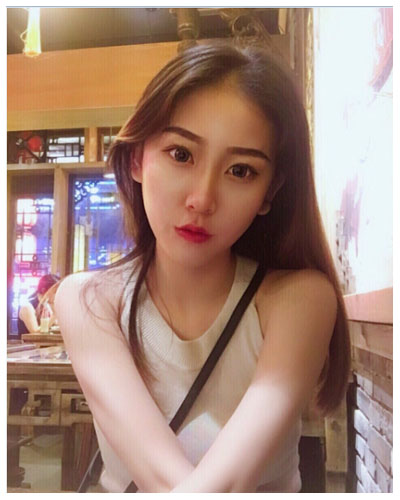 珠海海大整形美容外科黄发医生做面部吸脂怎么样？附面部吸脂案例