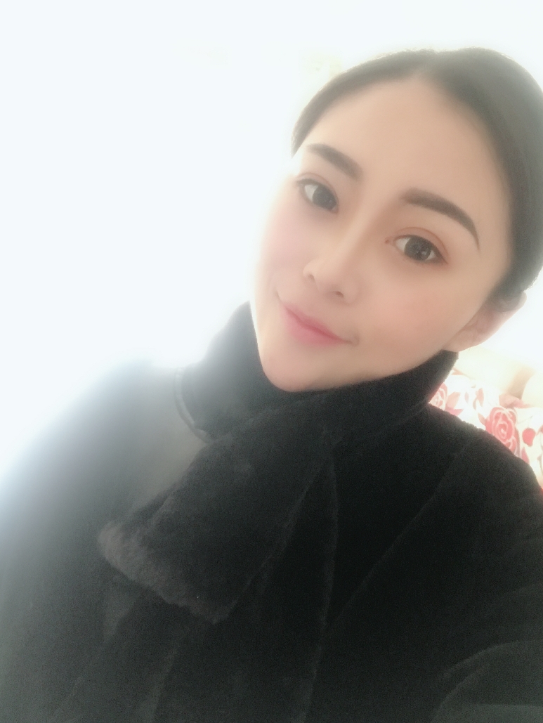 石家庄雅芳亚整形医生王文明做双眼皮+开眼角+鼻综合整形案例效果对比图