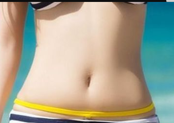 济南海峡美容整形医院腰腹吸脂