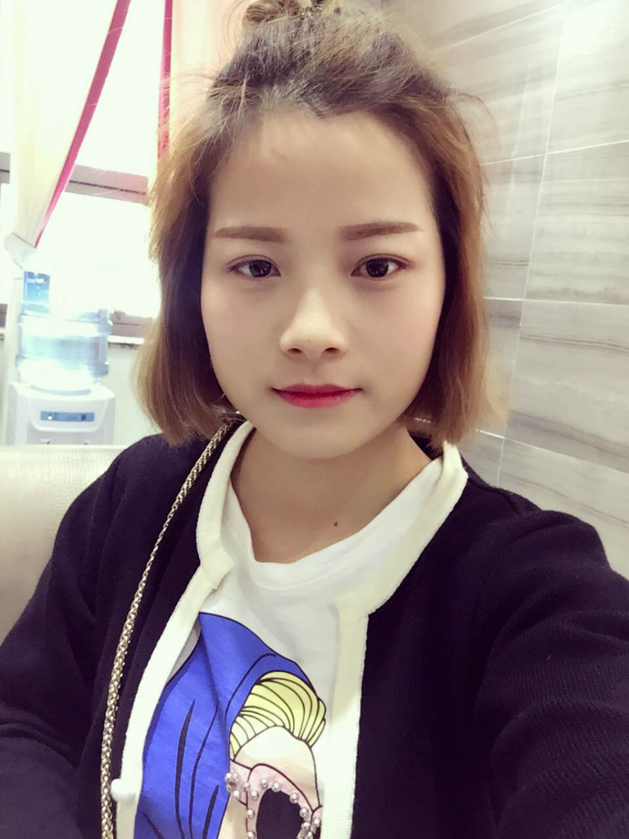 西安艺星医疗整形医院李国玲做鼻综合整形怎么样？附李国玲鼻综合整形案例