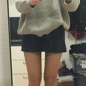 株洲雅美医疗整形医生车旺做大腿吸脂效果怎么样？附案例效果对比图