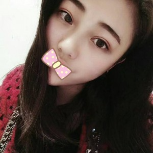 张家口维多利亚整形医院张凯医生做全切双眼皮真实案例效果对比图
