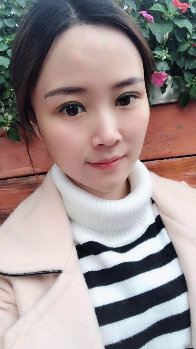 广东韩妃医疗美容医院做切开双眼怎么样？附案例效果图