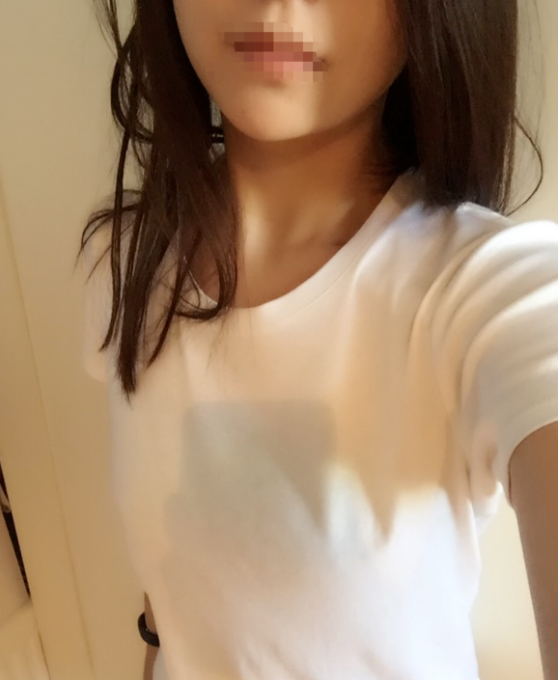 东莞韩美整形医院医生黄玉洁做假体隆胸怎么样？附案例效果图