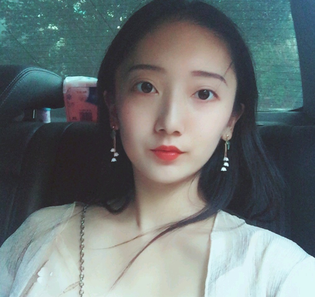 深圳鹏爱医疗美容医院医生文炯轸做埋线隆鼻怎么样？附案例